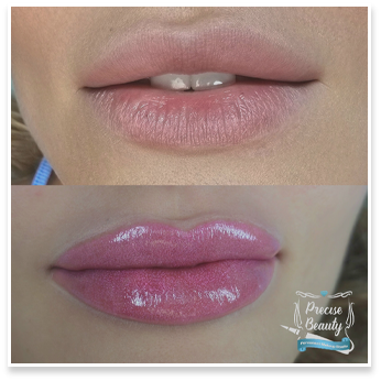 Lip Blushing
